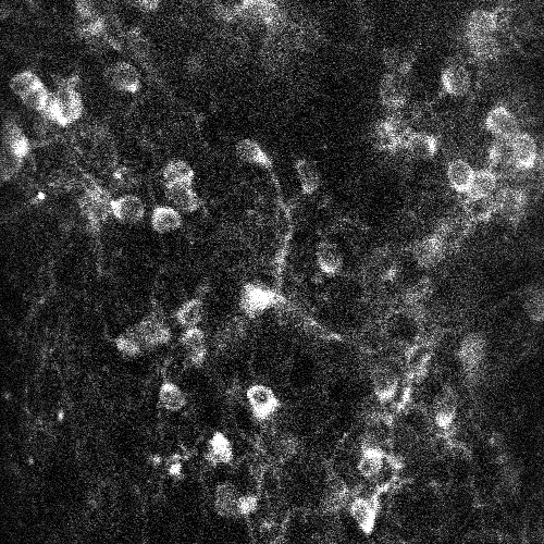 2P imaging of granule cells in the cerebellum